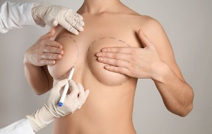 métodos de aumento de mama com cirurgia