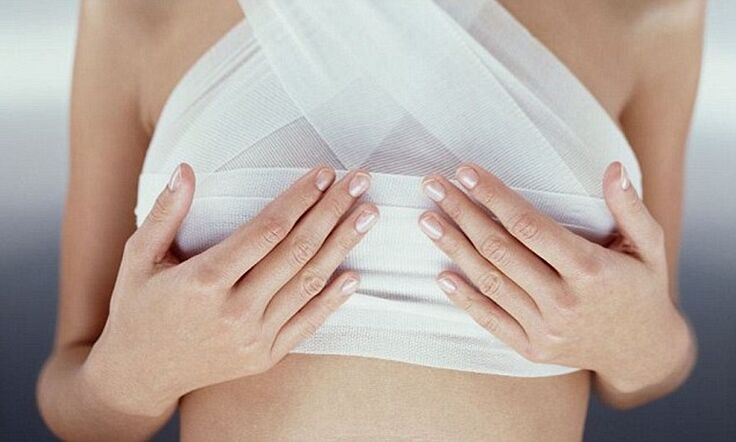 seios enfaixados após cirurgia de aumento de mama