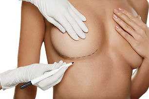 Marcação com um marcador antes da cirurgia de aumento de mama